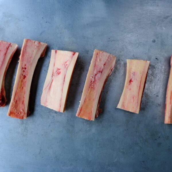 Bone Marrow Shafts